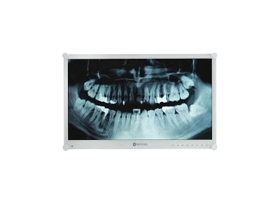 Neovo 24" DR-24G Dental Monitor, 1920x1080 FULL HD IPS, 5ms, HDMI, VGA, DP#1